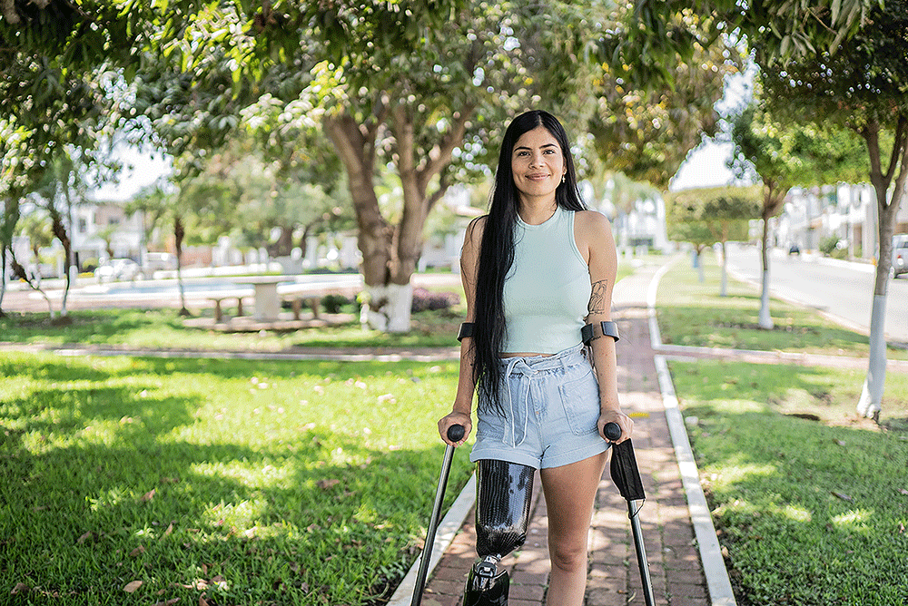An amputee woman smiles at the camera in a park